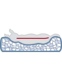 Cama ortopédica para perros, cojín trixie Vital Calito 2